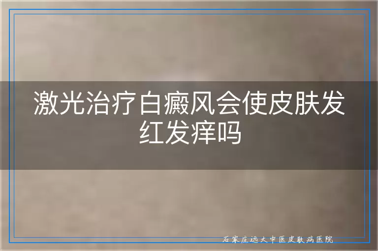 激光治疗白癜风会使皮肤发红发痒吗