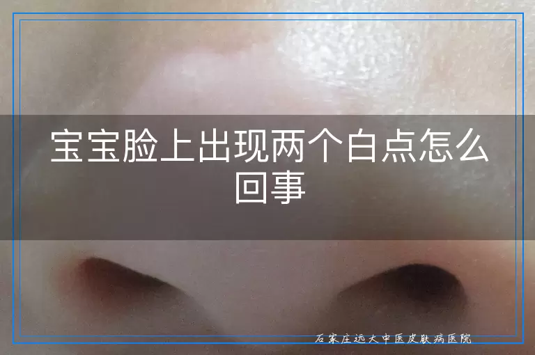宝宝脸上出现两个白点怎么回事