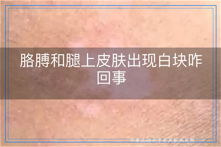 胳膊和腿上皮肤出现白块咋回事