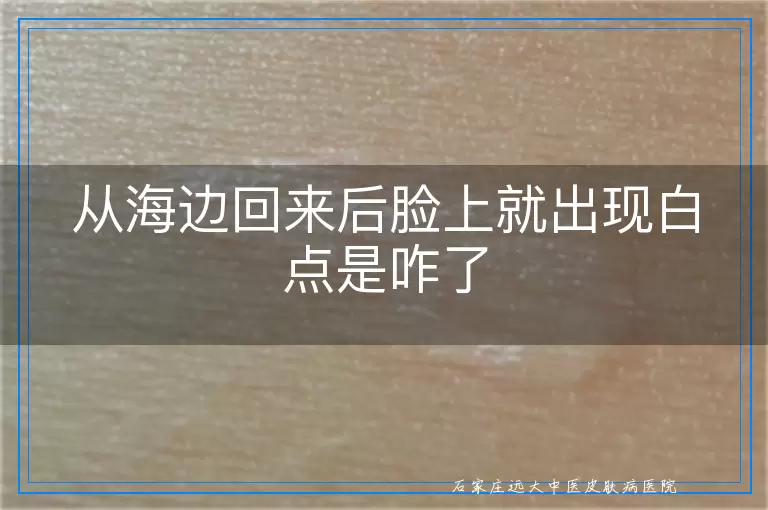 从海边回来后脸上就出现白点是咋了