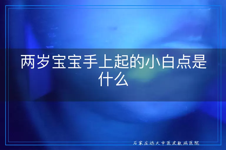 两岁宝宝手上起的小白点是什么