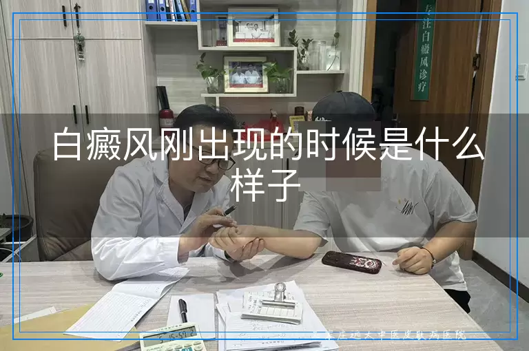 白癜风刚出现的时候是什么样子