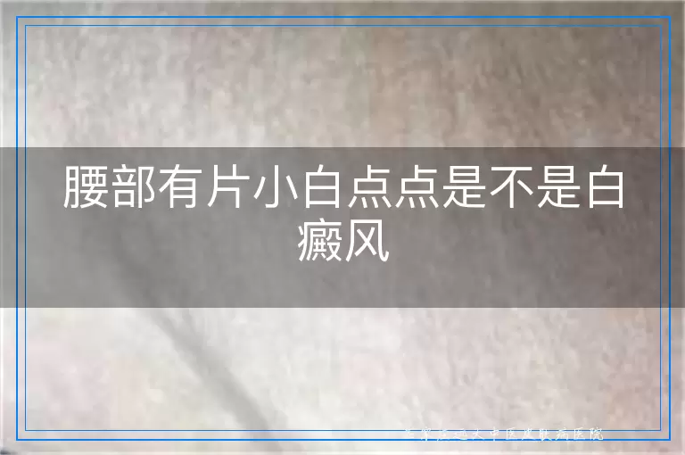 腰部有片小白点点是不是白癜风