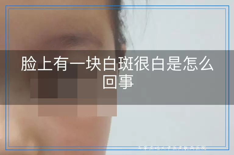 脸上有一块白斑很白是怎么回事