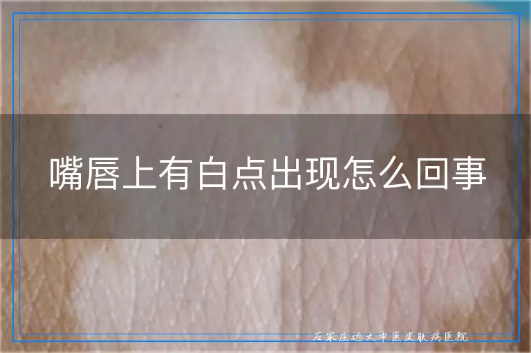 嘴唇上有白点出现怎么回事