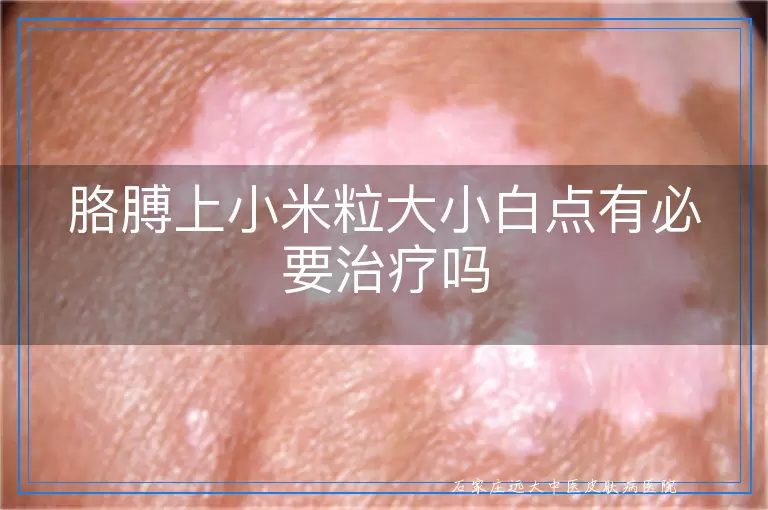 胳膊上小米粒大小白点有必要治疗吗