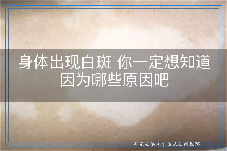 身体出现白斑 你一定想知道因为哪些原因吧