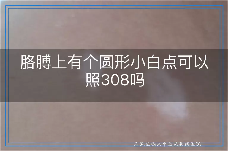胳膊上有个圆形小白点可以照308吗