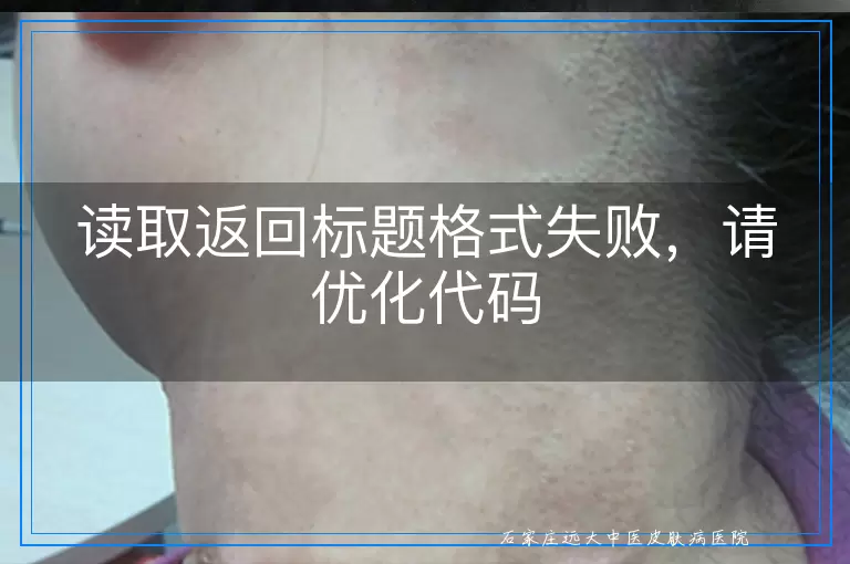 读取返回标题格式失败，请优化代码