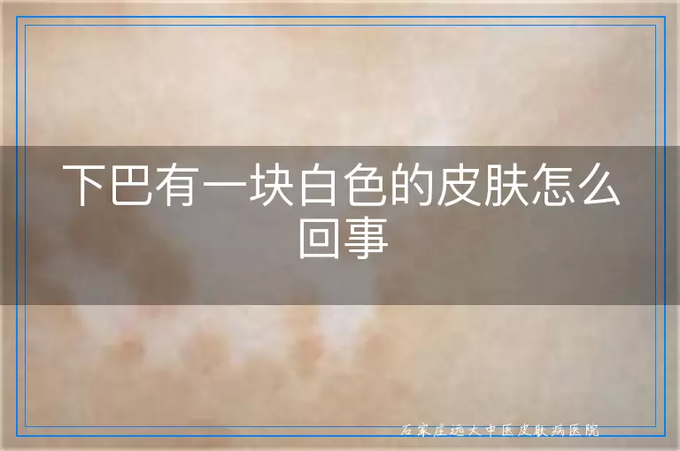 下巴有一块白色的皮肤怎么回事
