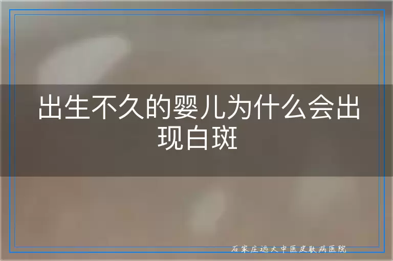 出生不久的婴儿为什么会出现白斑