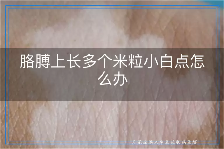 胳膊上长多个米粒小白点怎么办