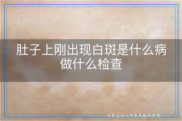 肚子上刚出现白斑是什么病做什么检查