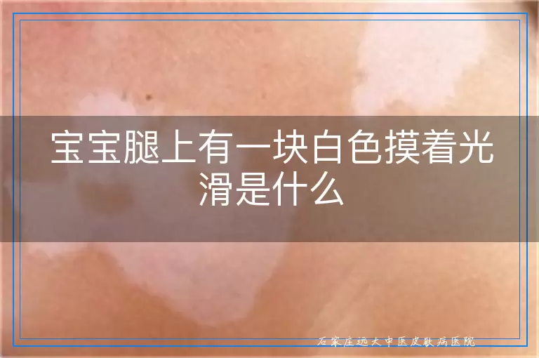宝宝腿上有一块白色摸着光滑是什么