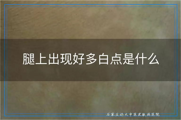 腿上出现好多白点是什么