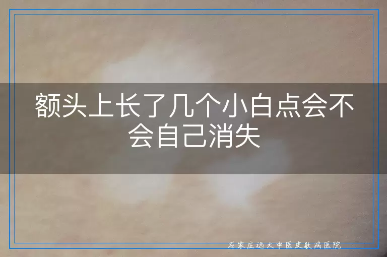 额头上长了几个小白点会不会自己消失