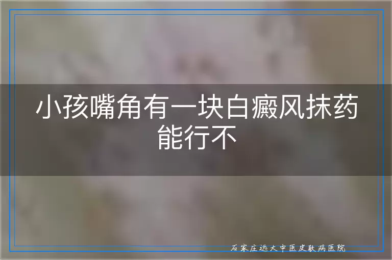 小孩嘴角有一块白癜风抹药能行不