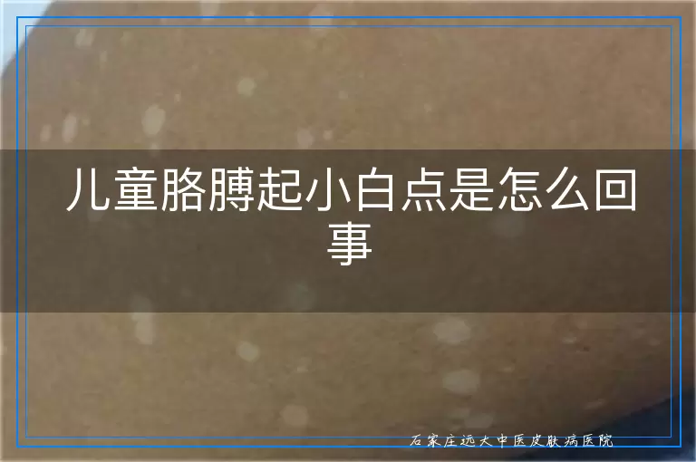 儿童胳膊起小白点是怎么回事