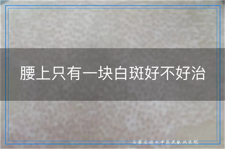 腰上只有一块白斑好不好治