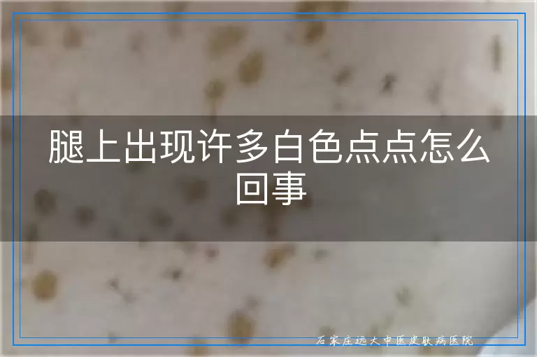 腿上出现许多白色点点怎么回事