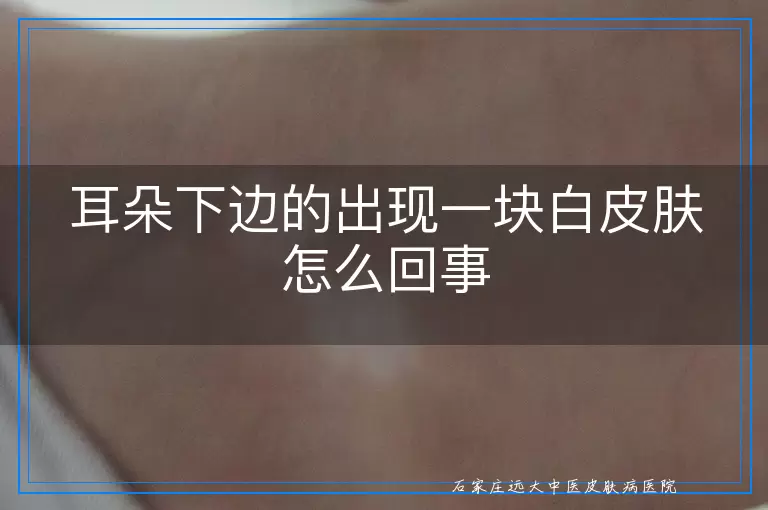 耳朵下边的出现一块白皮肤怎么回事
