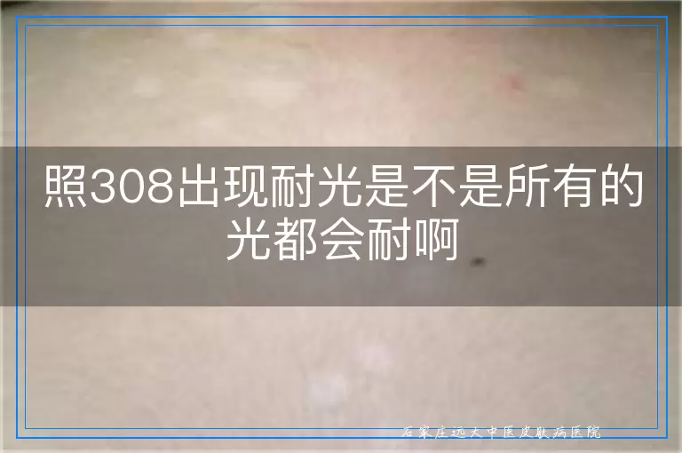 照308出现耐光是不是所有的光都会耐啊