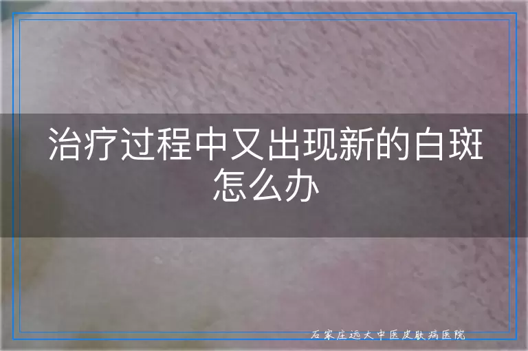 读取返回标题格式失败,请优化代码