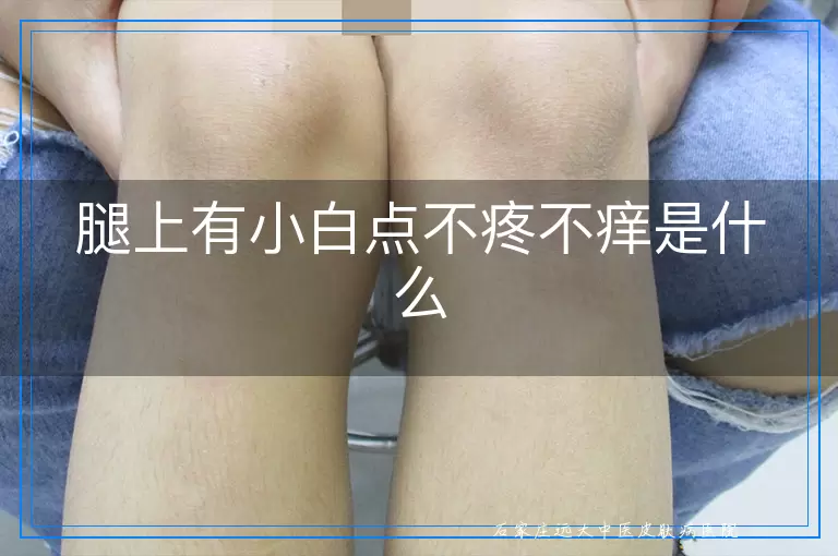 腿上有小白点不疼不痒是什么