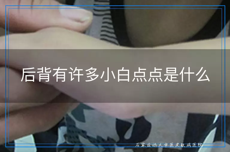 后背有许多小白点点是什么