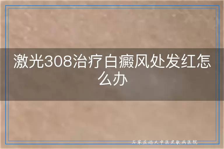 激光308治疗白癜风处发红怎么办