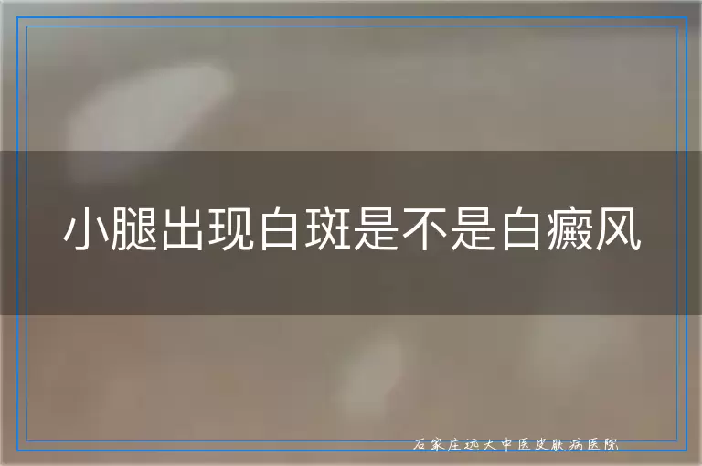 小腿出现白斑是不是白癜风