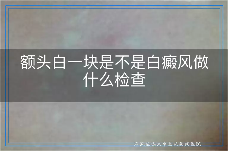 额头白一块是不是白癜风做什么检查