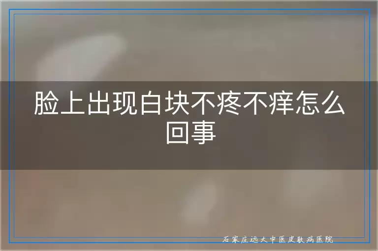 脸上出现白块不疼不痒怎么回事