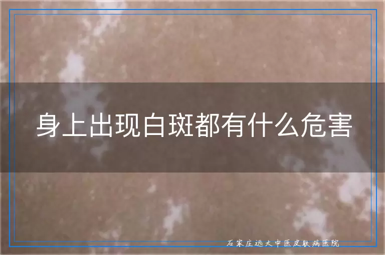 身上出现白斑都有什么危害