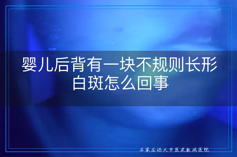 婴儿后背有一块不规则长形白斑怎么回事