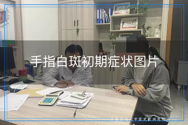 手指白斑初期症状图片