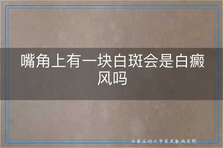 嘴角上有一块白斑会是白癜风吗