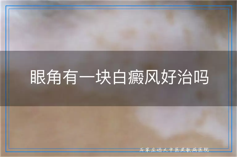 眼角有一块白癜风好治吗