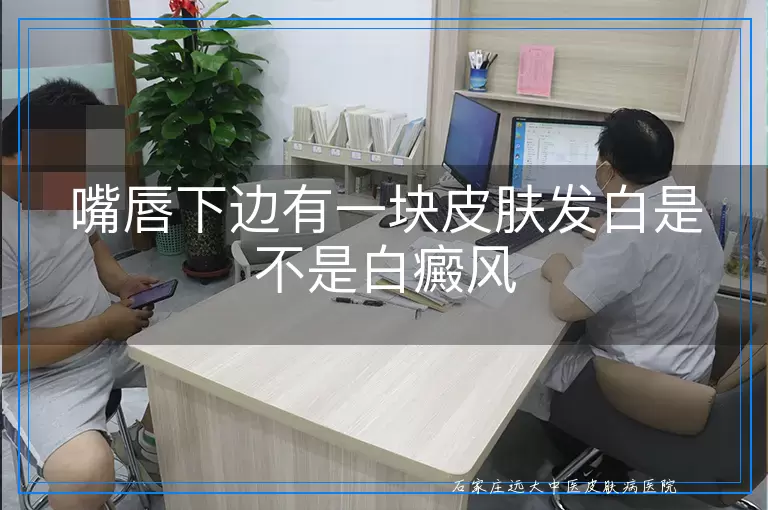 嘴唇下边有一块皮肤发白是不是白癜风