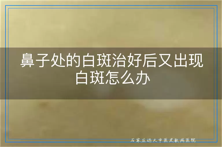鼻子处的白斑治好后又出现白斑怎么办