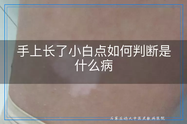 手上长了小白点如何判断是什么病