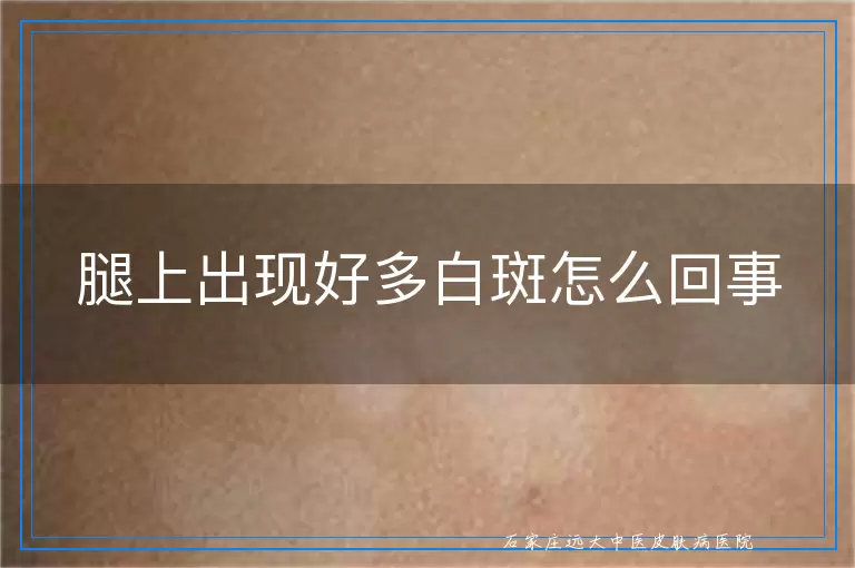 腿上出现好多白斑怎么回事