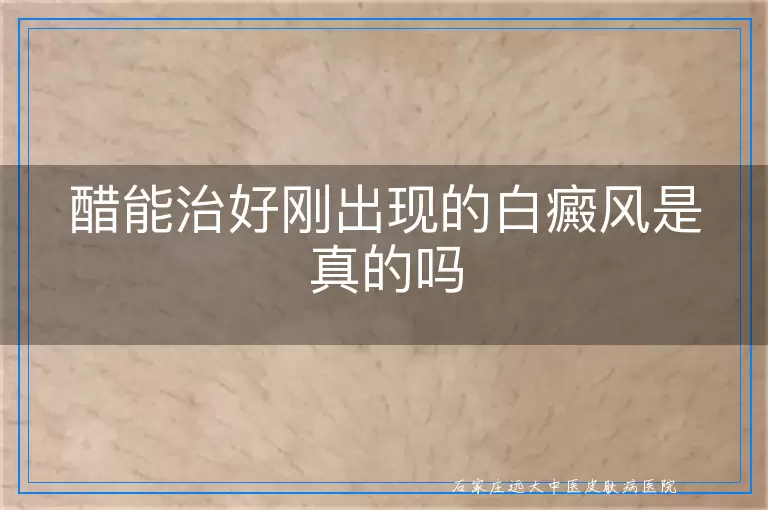 醋能治好刚出现的白癜风是真的吗
