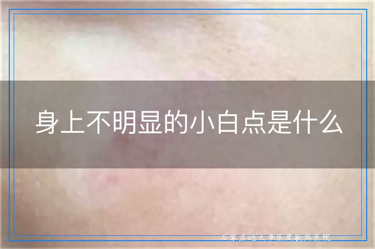 身上不明显的小白点是什么