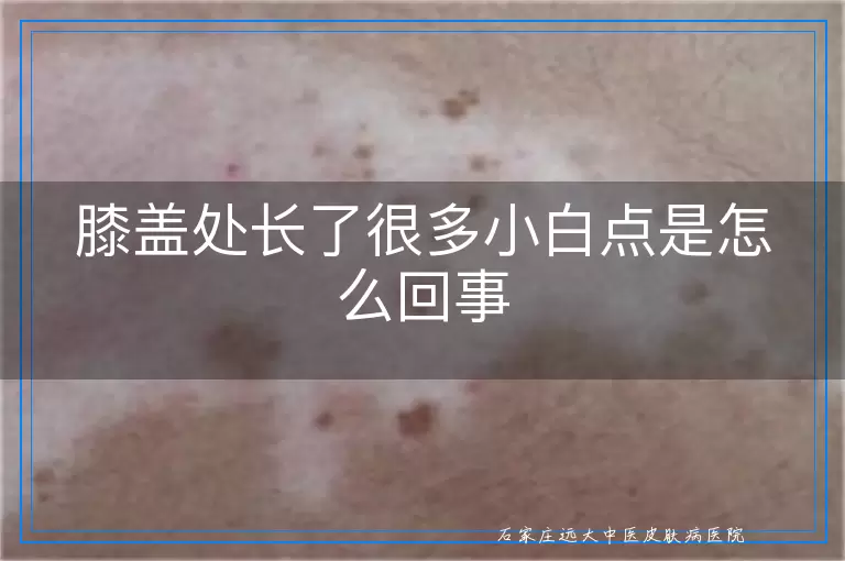 膝盖处长了很多小白点是怎么回事