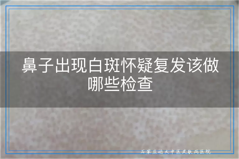 鼻子出现白斑怀疑复发该做哪些检查