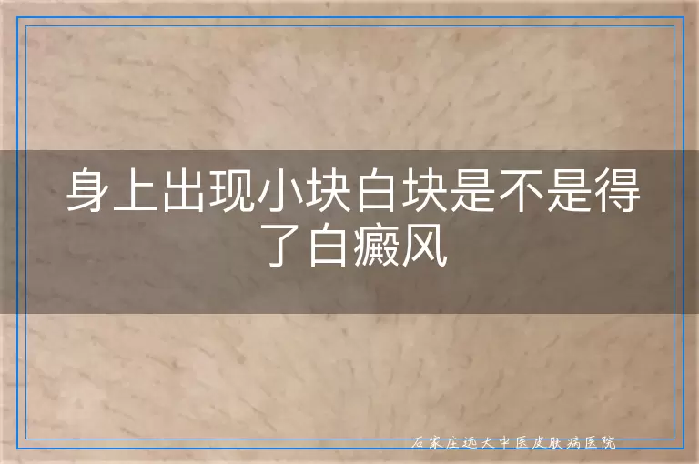 身上出现小块白块是不是得了白癜风
