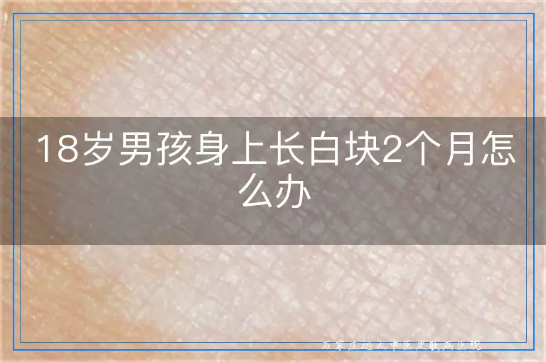 18岁男孩身上长白块2个月怎么办