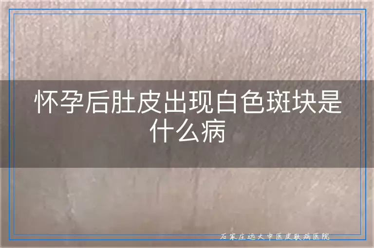 怀孕后肚皮出现白色斑块是什么病