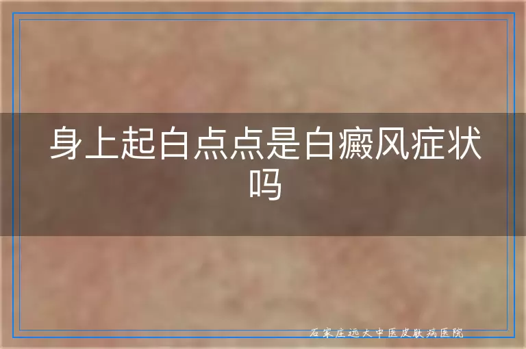 身上起白点点是白癜风症状吗